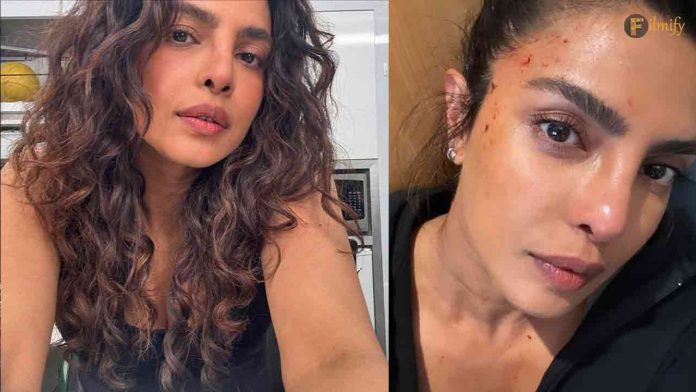 Priyanka Chopra’s Bloody Face: Real Injury or Movie Magic on The Bluff?