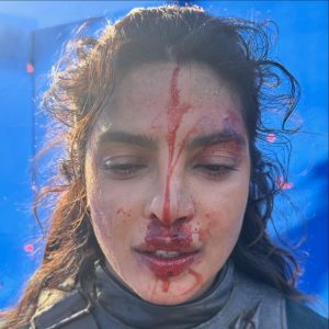 Priyanka Chopra’s Bloody Face: Real Injury or Movie Magic on The Bluff?